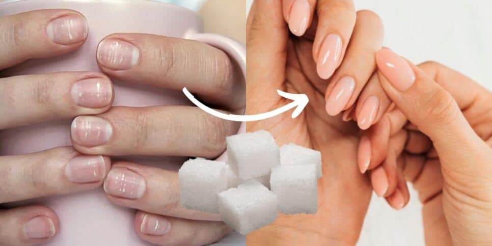Nem acetona faz isso: Misturinha com açúcar tira 100% do esmalte sem deixar unhas brancas em 1 minuto