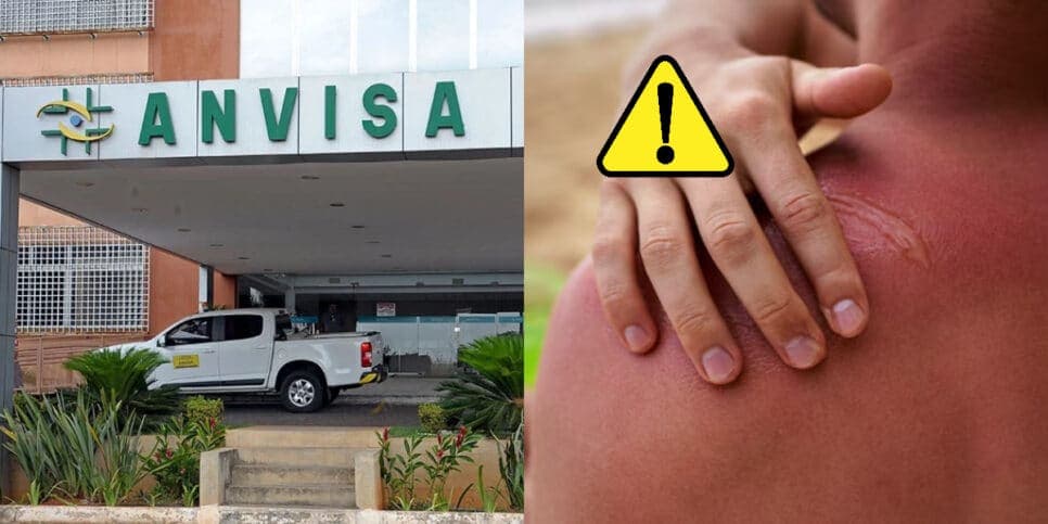 Barrado em todo território nacional e risco de queimadura: Anvisa proíbe produto aclamado em 2024