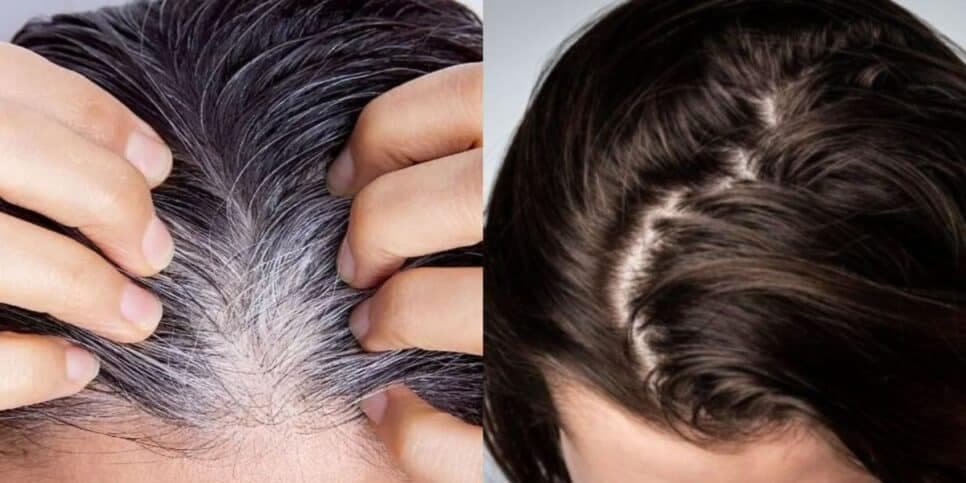 ADEUS cabelo branco e química zero: Receitinha caseira só com 4 ingredientes e que devolve 20 anos das 60+