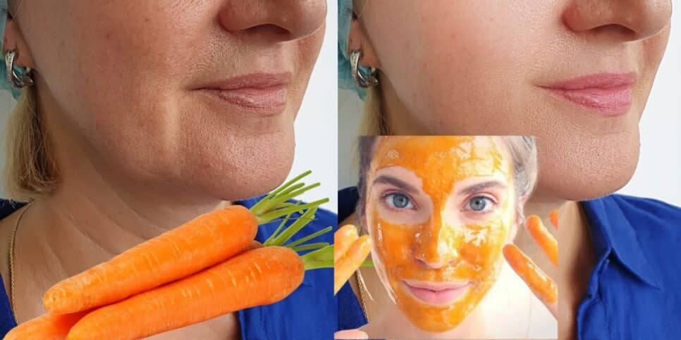 Fim das rugas: Harmonização facial caseira com cenoura traz pele de porcelana e rejuvenesce 30 anos