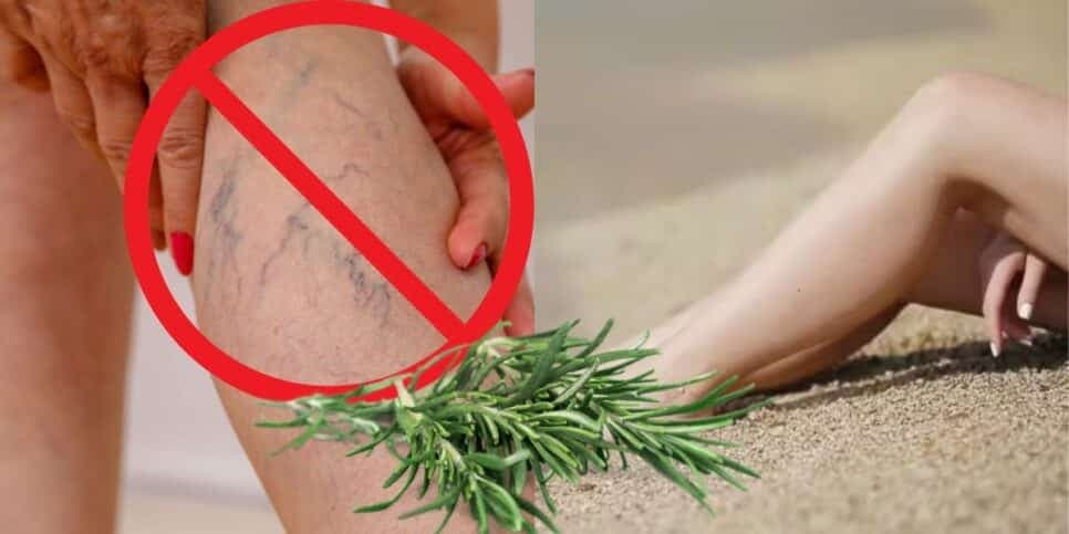 Adeus manchas e varizes: Chá caseiro com alecrim e +2 ingredientes deixa a perna lisa e sem rugas