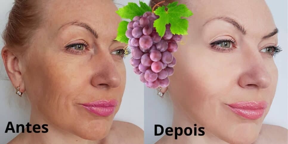 Adeus ao botox: Misturinha caseira com uva e +3 ingredientes salva a pele das mulheres melhor que colágeno