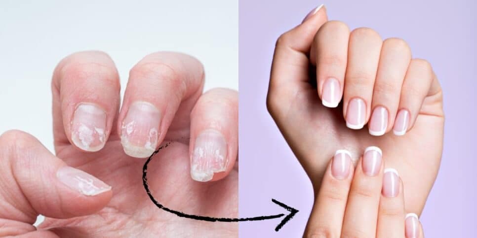 Laranja, produto proibido e mais 1: Esses 3 truques deixam as unhas inquebráveis até no frio