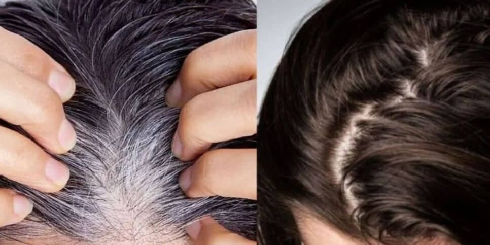 Fim da linha para o grisalho e queda: Tinta natural com único ingrediente reverte todo cabelo branco