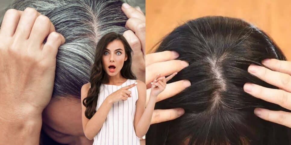Fim dos grisalhos e sem tinta: Mistura caseira com 2 ingredientes revertem o cabelo em apenas 30 minutos
