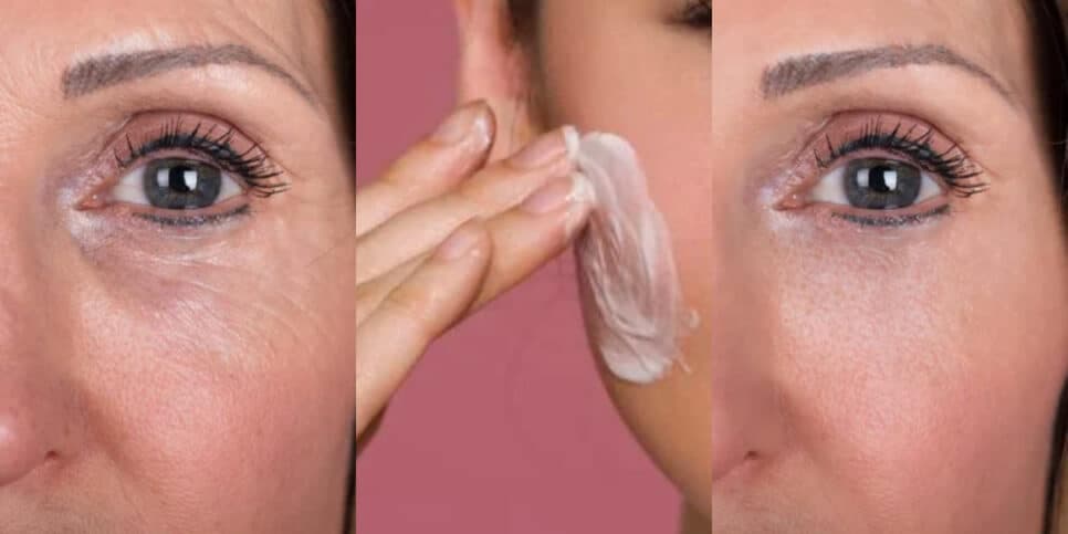 Elixir da juventude: Botox caseiro com único ingrediente aniquila as rugas e traz pele de porcelana às 45+
