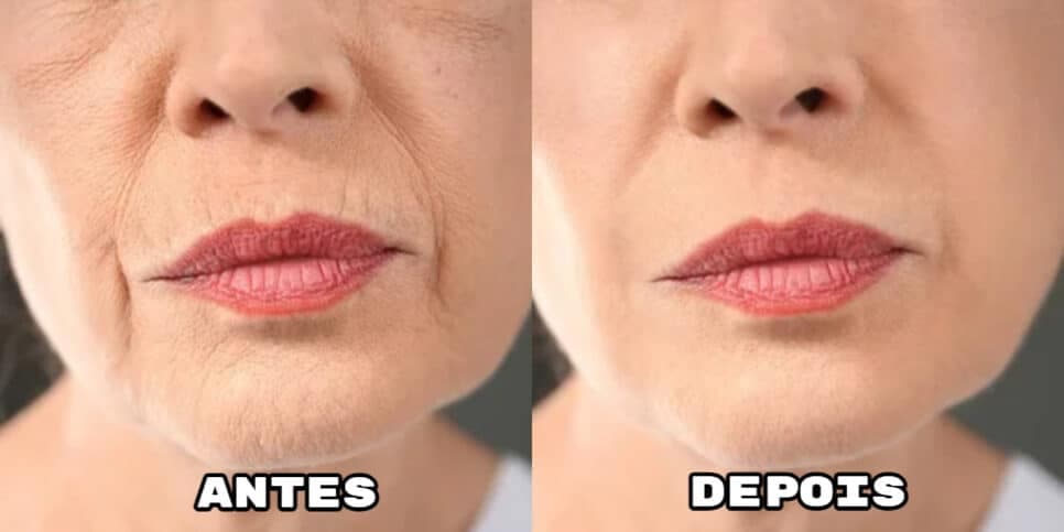 Adeus às rugas: Receitinha com 4 ingredientes é melhor que botox, deixa pele lisinha e rejuvenesce às 50+