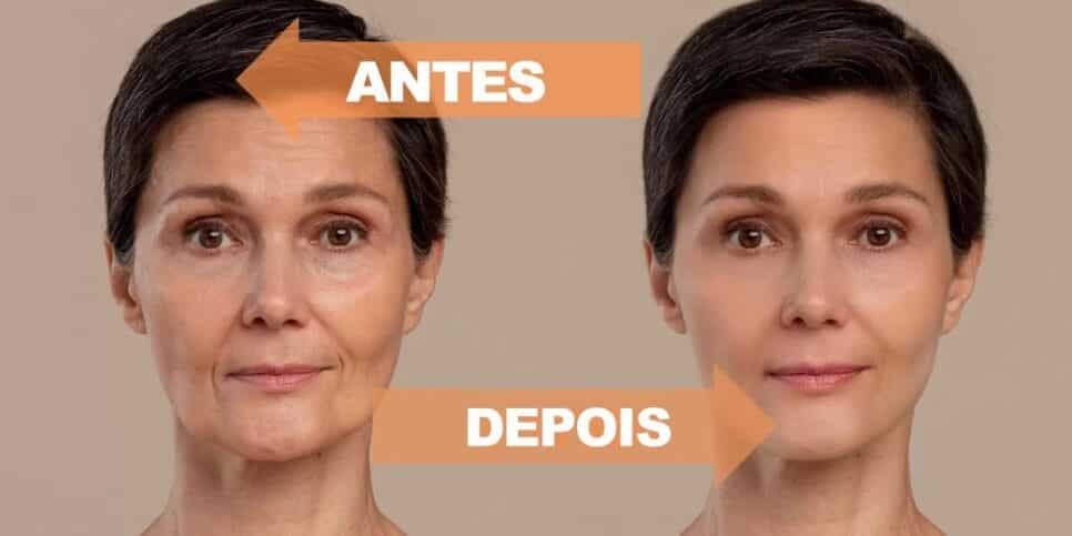 Fim da flacidez e rugas: Máscara efeito botox com 4 ingredientes traz pele de seda as 60+