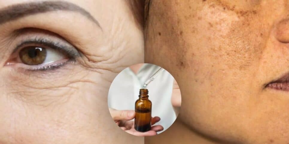 Adeus rugas e manchas: Único ingrediente caseiro traz pele de porcelana e faz mulheres desistirem do botox