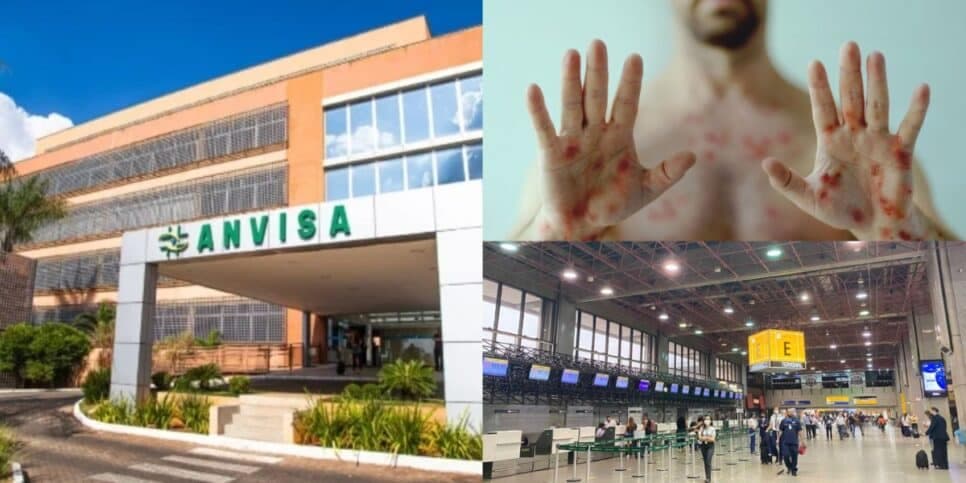 Alerta máximo no Brasil: ANVISA é obrigada a agir às pressas em aeroporto de SP por doença pior que a Dengue