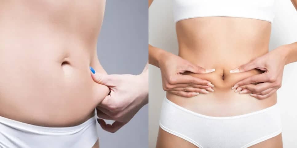 Fim da flacidez na barriga: Receita infalível com 4 ingredientes rejuvenesce sua pele em poucos dias