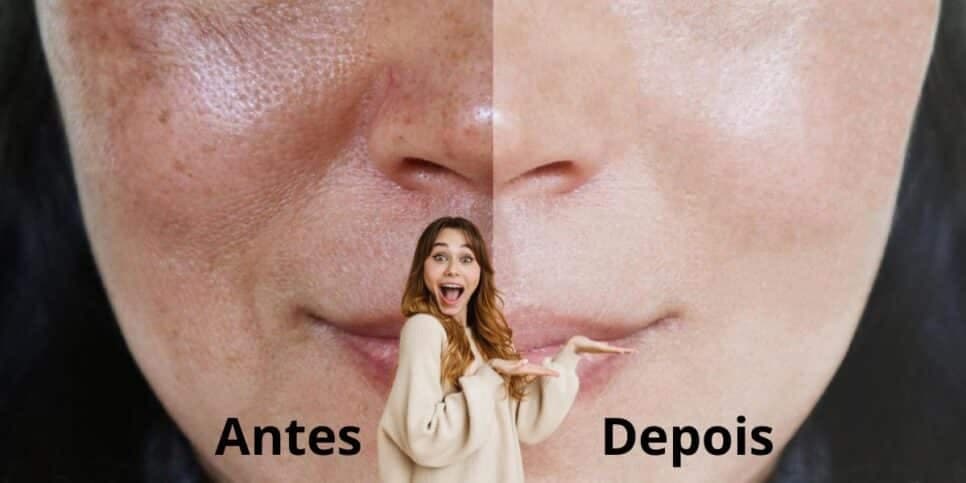 Pele de seda e sem manchas: 2 ingredientes rejuvenescem em 2 décadas todas as mulheres sem sair de casa