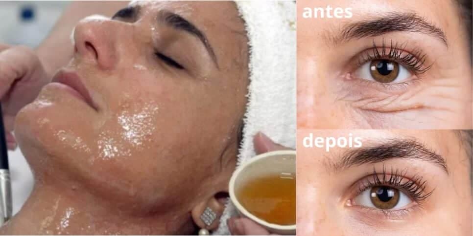Pé de galinha e rugas nunca mais: Misturinha com mel e +2 ingredientes rejuvenesce e acaba até bigode chinês