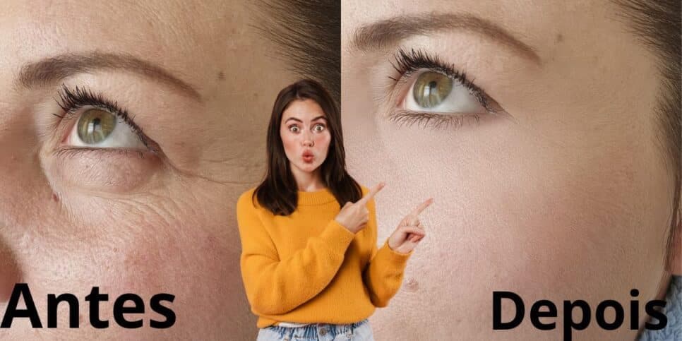 Fim das rugas e botox totalmente de graça: Misturinha com 3 ingredientes para mulheres voltarem aos 30 anos