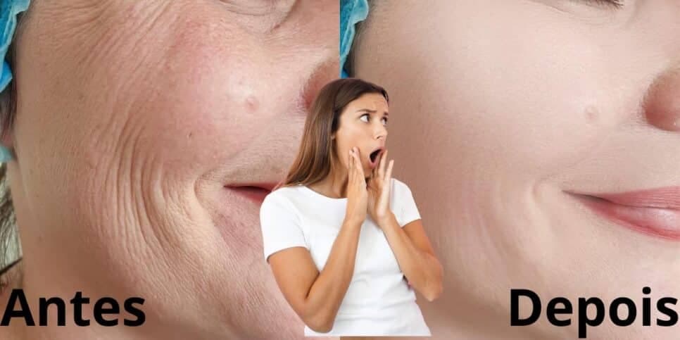 Melhor que o Botox: Único produtinho rejuvenesce a pele das mulheres 60+ para voltarem a ter rostinho de 25