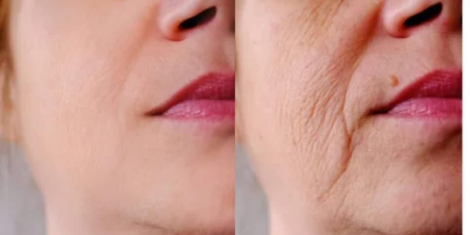 Fim das rugas e das manchas na pele: Único ingrediente traz pele de porcelana em 15 minutos às mulheres 50+