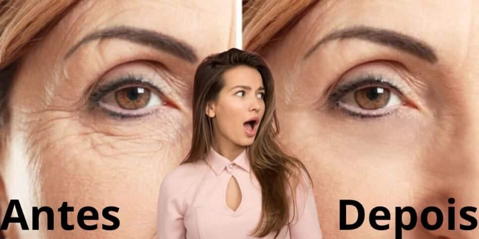 Adeus ao botox: Mistura caseira com 2 ingredientes traz pele de porcelana e fim das rugas para as mulheres