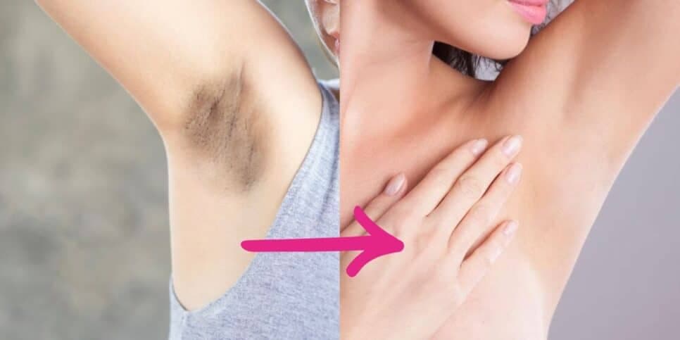 Nem Rexona faz isso: Desodorante natural com 3 ingredientes elimina mau cheiro e manchas nas axilas