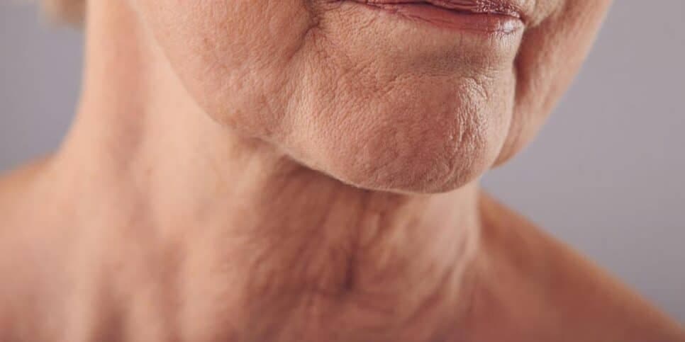 Fim da papada, flacidez e rugas no pescoço: Botox caseiro rejuvenesce idosas 60+ em 14 dias