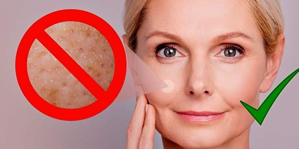 Nem precisa ir ao salão: 6 passos caseiros para fechar os poros do rosto de vez e ter pele de porcelana