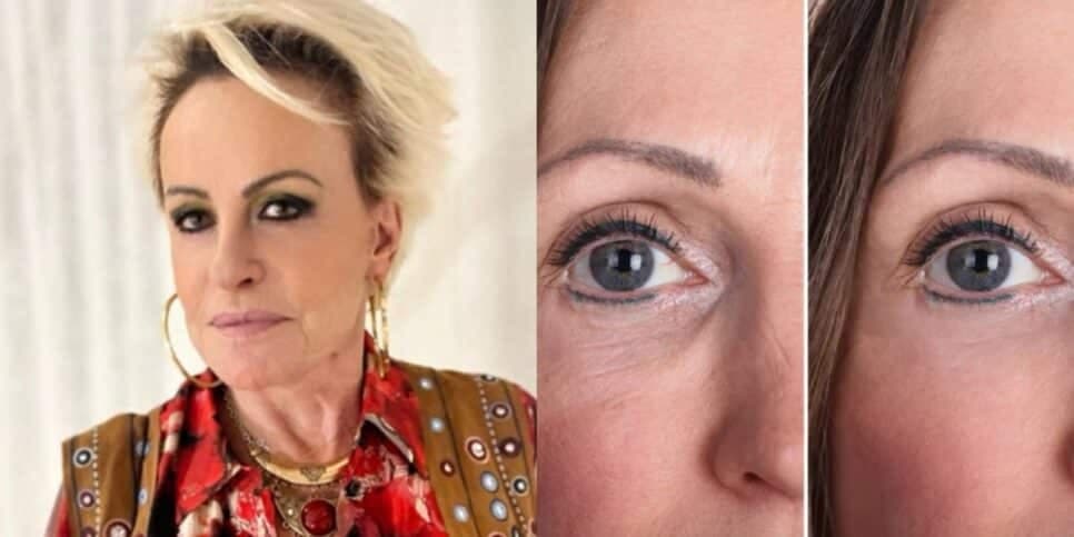 FIM das rugas: Receitinha da Ana Maria com ingrediente infalível traz o melhor colágeno DO MUNDO pra voltar aos 40