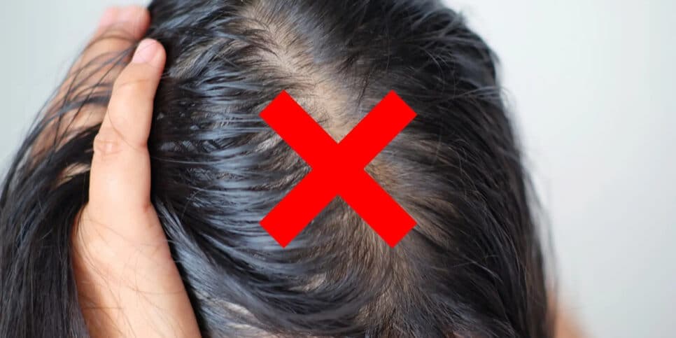 Adeus cabelo oleoso: Único ingrediente 100% natural revitaliza seus fios em casa