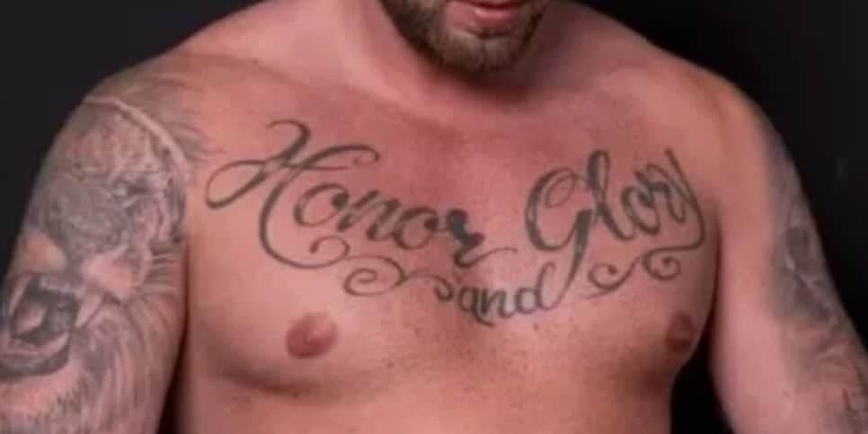 Famoso faz cirurgia para aumento do pênis e gera choque com foto do antes e depois