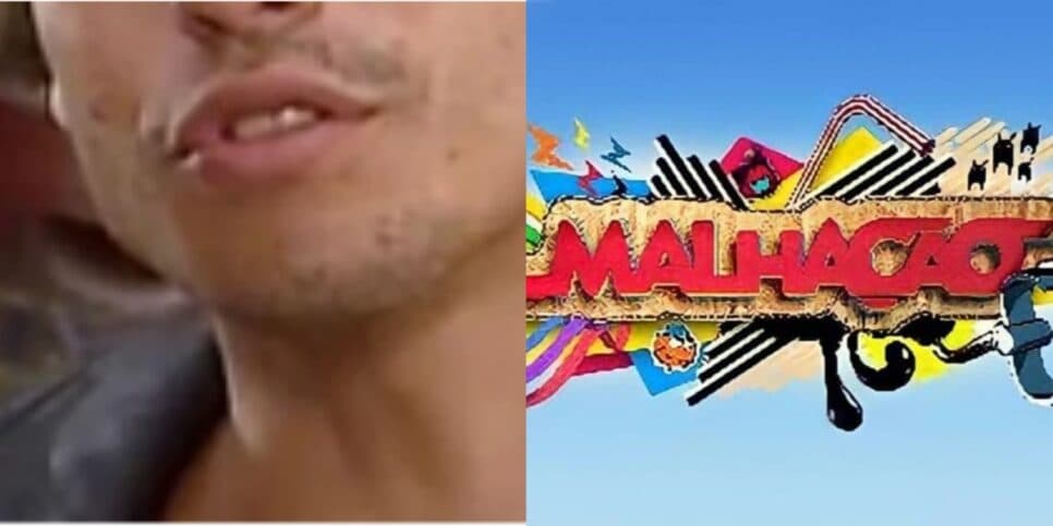 Galã de Malhação assume fundo do poço e vício em drogas após trabalho na Globo: "Destruiu minha vida"