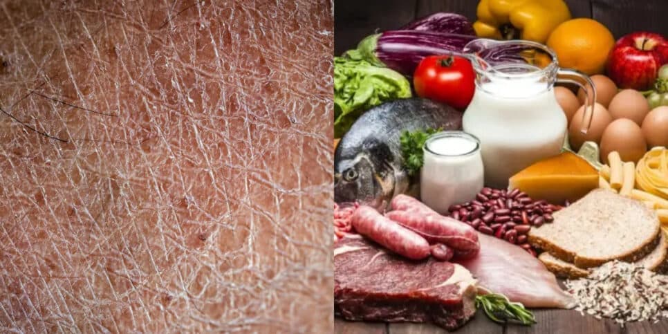 Elimina pele ressecada: Único alimento popular deixa às 50+ com 20 de novo