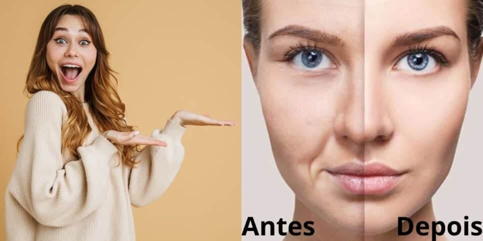 Fim do bigode chinês, estrias e rugas: Descobrimos o melhor colágeno