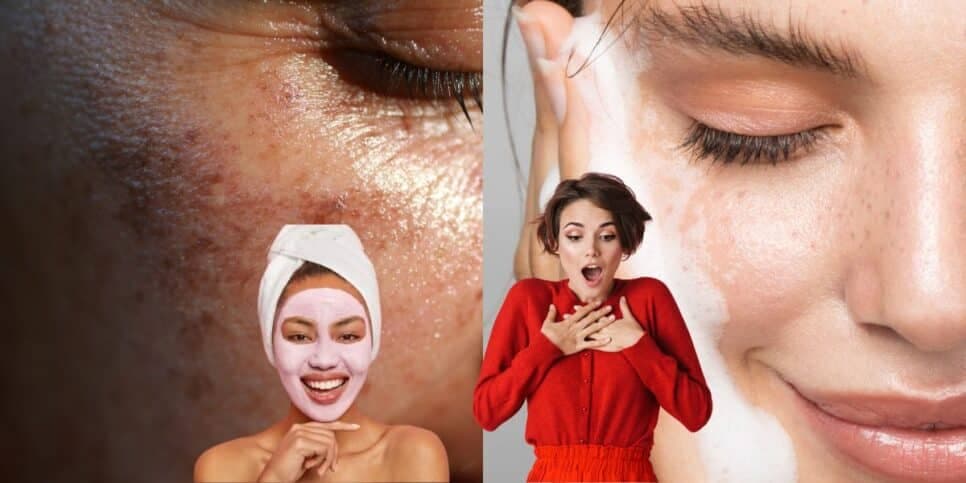 Fim das manchas e rugas: Misturinha com 3 ingredientes populares traz pele de porcelana às mulheres 50+