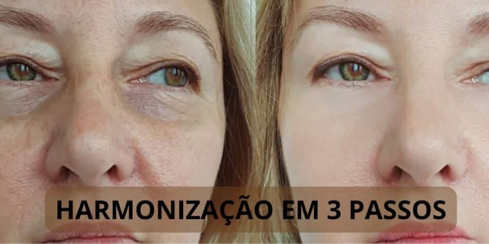Resultado IMEDIATO: Harmonização facial caseira em 3 passos infalíveis rejuvenesce as 60+ sem plástica