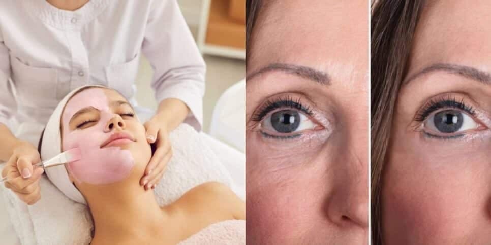 Melhor que botox: Creme natural com apenas 3 ingredientes acaba de vez com as rugas