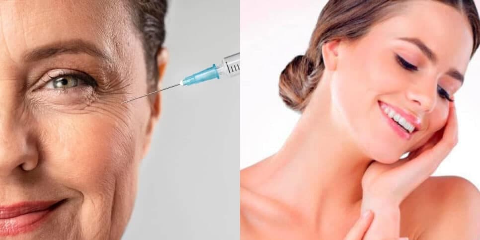 Melhor que botox: Creme antirrugas caseiro elimina às rugas e deixam às 50+ com pele de porcelana