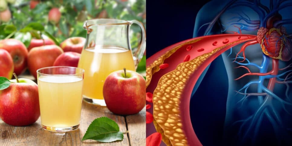Adeus colesterol e seca a gordura: Suco infalível de maçã e +2 ingredientes populares emagrece até 10 kg