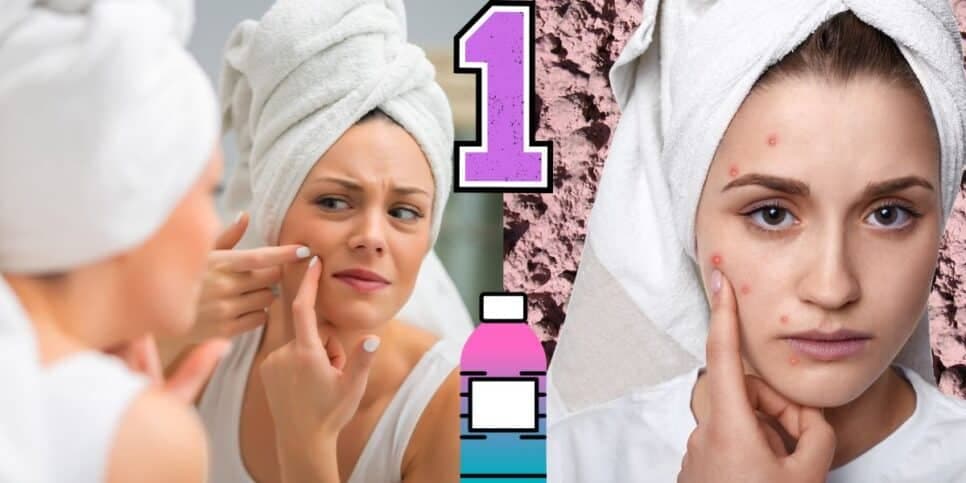Adeus espinhas e cravos: Único ingrediente poderoso elimina acne e traz pele de seda às 40+