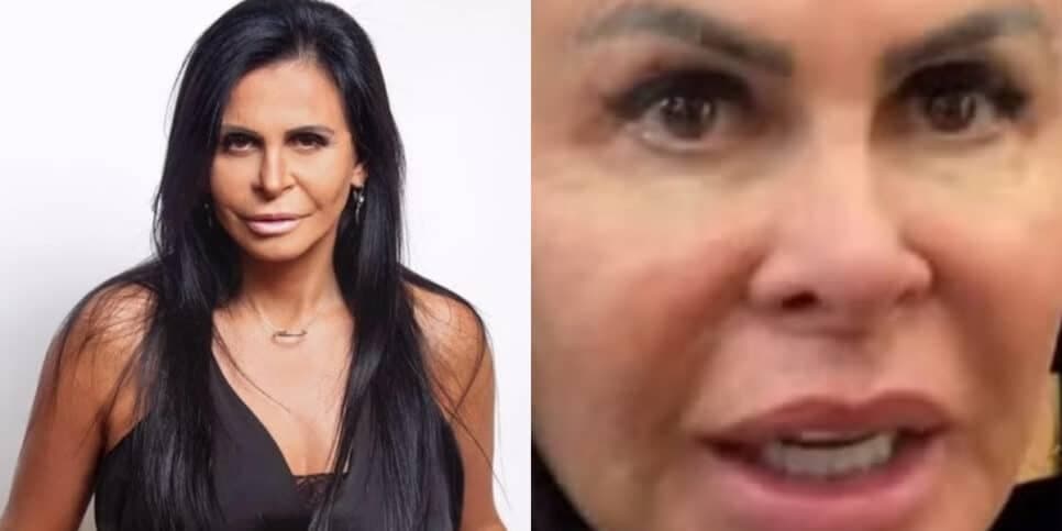 Gretchen surge careca e faz confissão chocante: "Perdi todo o cabelo"