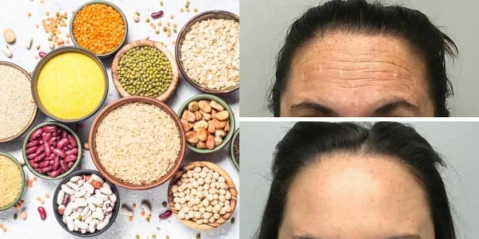 Botox natural com 1 ingrediente de cozinha suga rugas instantaneamente