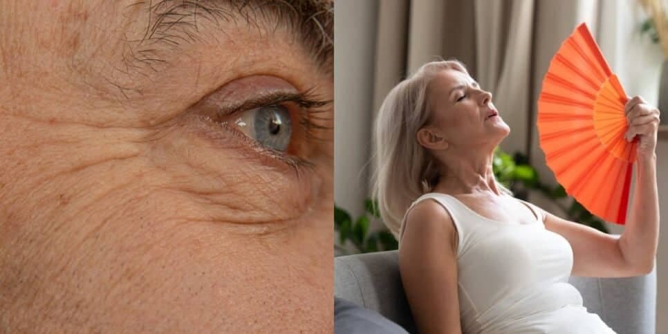3 passos infalíveis sugam rugas e retardam o envelhecimento de mulheres na menopausa
