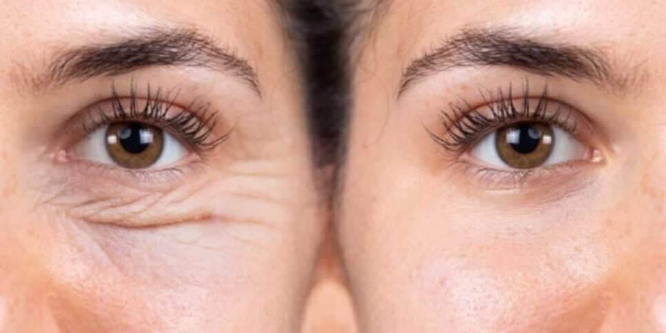 Pele firme e renovada: Como remover rugas do rosto usando apenas 1 ingrediente natural