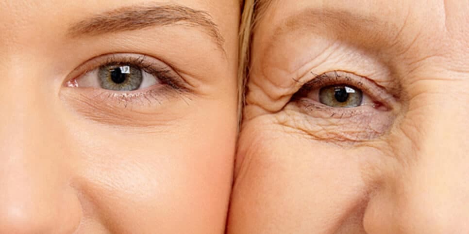 Adeus rugas e linhas de expressão: Botox caseiro com apenas 4 ingredientes deixa mulheres 40+ com pele de bebê