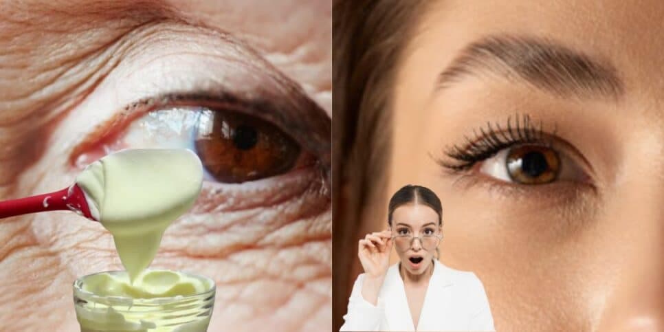 Fim do pé de galinha e rugas: Colágeno natural com 3 ingredientes rejuvenesce as mulheres 50+
