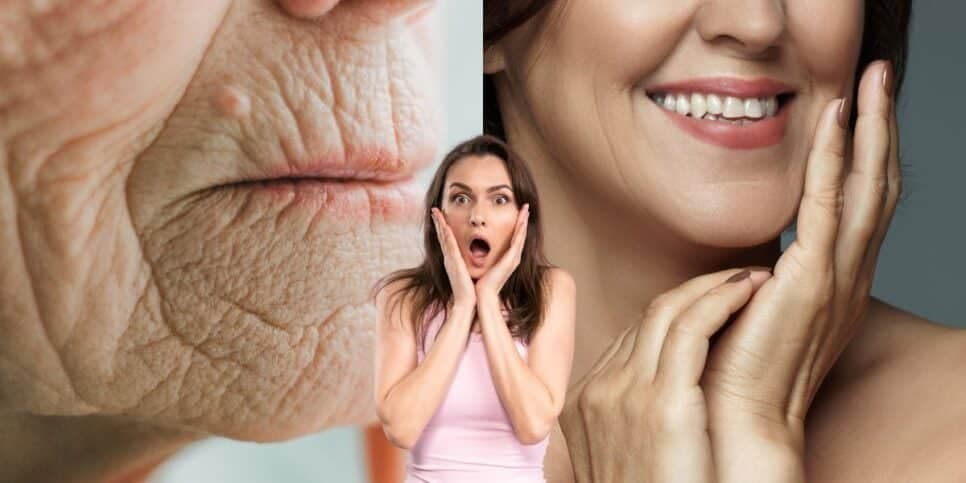 20 anos outra vez: Botox caseiro com apenas 3 ingredientes traz FIM das rugas