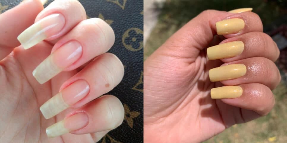 Fortes e inquebráveis: 7 alimentos populares para ter unhas indestrutíveis