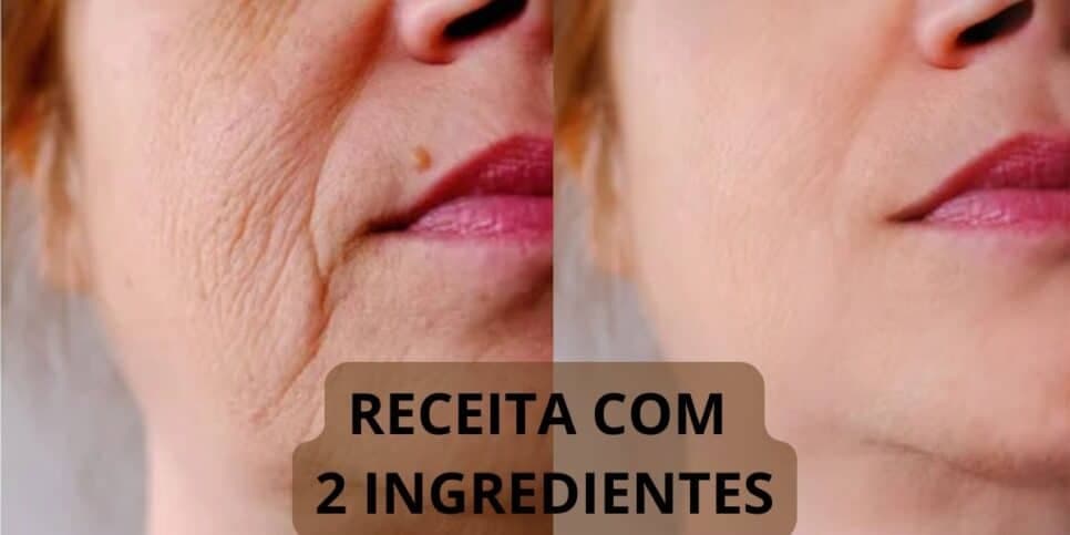 Harmonização caseira sem gastar 1 real: 2 ingredientes rejuvenesce enquanto dorme e elimina rugas