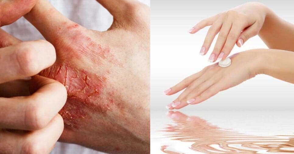 Fim das rugas e manchas nas mãos: Mistura natural com azeite +1 ingrediente deixa pele lisinha