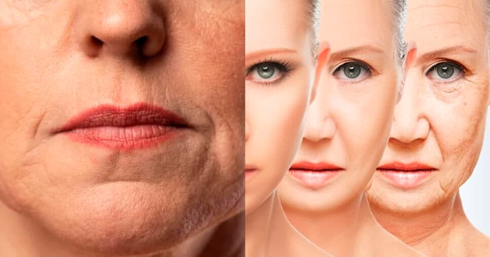 Adeus, plásticas: Lifting natural caseiro em 5 passos infalíveis garante fim das rugas e bigode chinês