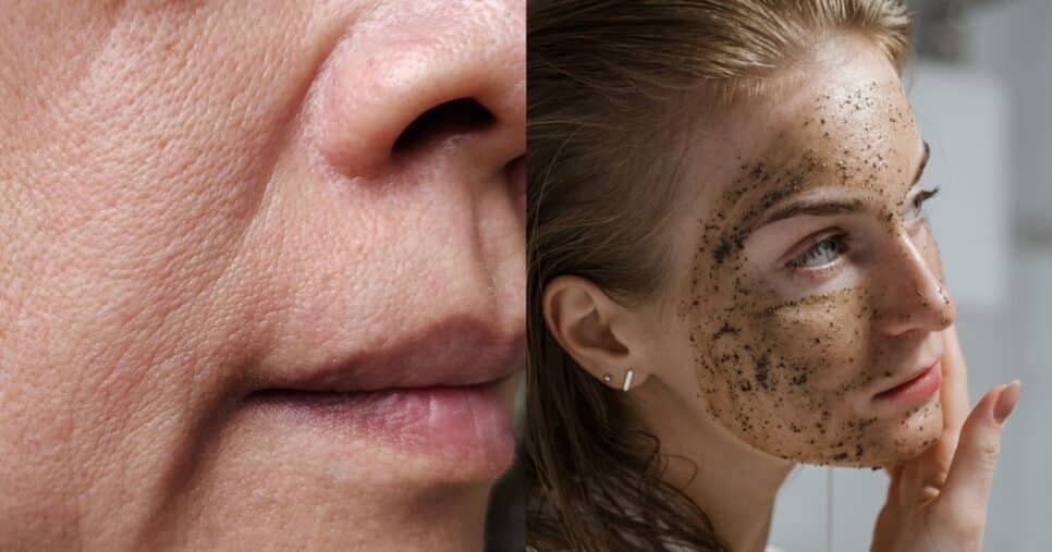 Harmonização facial caseira: Mistura com 4 ingredientes dá fim às rugas e linhas de expressão