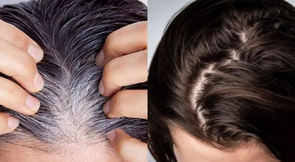 Fim da tinta com amônia: Mistura com 2 ingredientes acaba de vez com o grisalho e ressuscita o cabelo danificado