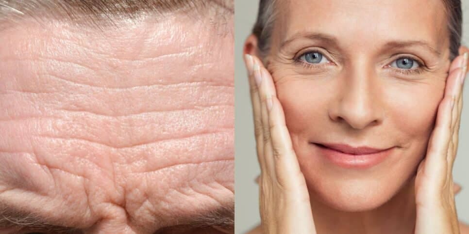 Para esquecer harmonização facial: Óleo secreto traz FIM das rugas e estica pele em 30 minutos